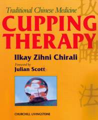 Cupping Therapy